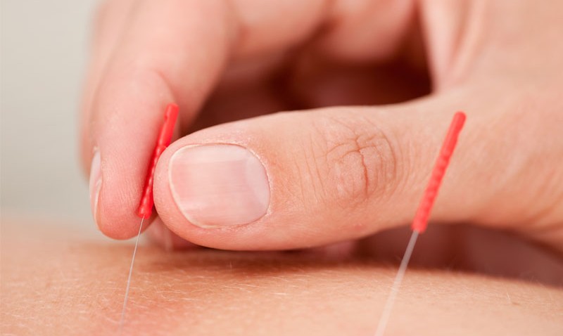 Haluksy Medycyna Wschodnia Leczenie Akupunktura 