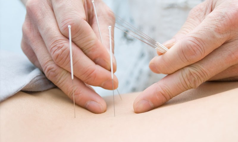 Niewydolność krążenia Akupunktura Medycyna Wschodnia leczenie 